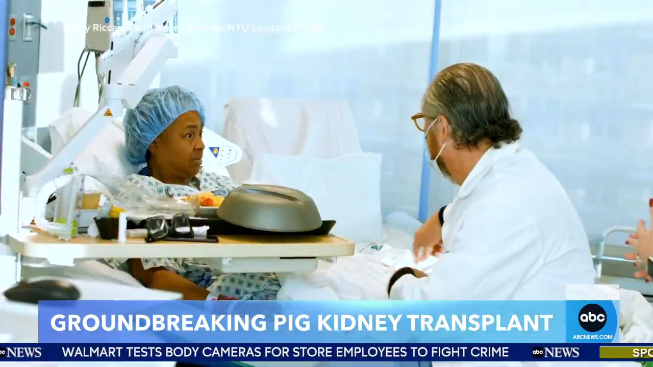 An Alabama woman has become only the fifth person in the world to receive a genetically modified organ from a pig after undergoing a kidney transplant, Video An Alabama woman has become only the fifth person in the world to receive a genetically, Moscow News HOT Today Video, Video news hot, Video Russia News HOT Today, News hot today, The hottest news in 2023, Hot news today on the world, Hot News Video, Hot news today, NFL News HOT Video, Post news hot today