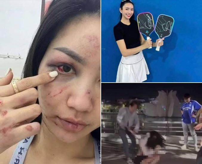 Video được cho là tiểu tam thách thức chính thất, FULL CLIP em nhân viên ngân hàng CỰC XINh bị đánh ghen HOT NHẤT MXH, FULL CLIP em nhân viên ngân hàng CỰC XINh bị đánh ghen, Clip đánh ghen lột đồ hot nhất mạng xã hội, Clip tiểu tam ngân hàng bị đánh giữa đường tuột quần áo, Clip tiểu tam bị đánh giữa đường tuột quần áo, Clip tiểu tâm ngân hàng thách thức chính thất, Clip đánh ghen tuột quần áo, Clip đánh ghen ngân hàng lột quần áo, Full clip đánh ghen ngân hàng, Full CLIP Đánh Ghen nữ nhân viên ngân hàng NÓNG NHẤT Hôm Nay, Clip đánh ghen ngân hàng, Clip nhân viên ngân hàng đánh ghen, Clip đánh ghen nhân viên ngân hàng, Clip đánh ghen Cần Thơ, Clip đánh ghen nóng nhất hôm nay, Clip đánh ghen ngân hàng ở Cần Thơ, Clip Đánh ghen mới nhất, Clip đánh ghen em nhân viên ngân hàng xinh đẹp, Clip em nhân viên ngân hàng đánh ghen, Clip đánh ghen lột đồ, Clip đánh ghen