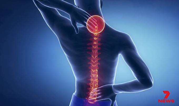 95% of Back Pain Patients Don't Need Scans Study Finds, The Best Treatment for Back Pain Isn't Surgery Scientists Say, New Study Reveals the Most Effective Cure for Back Pain, How to Relieve Back Pain Naturally: What Australian Researchers Discovered, best treatment for back pain, most effective way to treat back pain, how to relieve back pain naturally, New South Wales back pain study, Australian research on back pain, do you need an MRI for back pain, best exercises for lower back pain recovery, how to recover from back pain without surgery, evidence-based treatment for back pain, back pain treatment Australia, Video Clip Life Healthy, Clip đời sống, Clip Đời Sống Du Lịch, Clip health and lifestyle Australia, Australia daily news update, Australia breaking news today, Breaking Australia News, Top Australia News Today, Australia Breaking News, Clip giải trí, Clip giải trí trên mạng xã hội