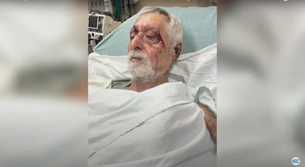 ALZHEIMER’S DISEASE, VIDEO CRIME NEWS, DEMENTIA NEWS, HOUSTON NEWS, ROBBERIES NEWS, TEXAS NEWS, Clip 2 men viciously beat 67-year-old Houston man with Alzheimer’s after he tried getting in wrong car, Video 2 men viciously beat 67-year-old Houston man with Alzheimer’s after he tried getting in wrong car, Getting into the wrong car a 67-year-old man with Alzheimer's disease suffered a broken facial bone, Video clip 67-year-old man with Alzheimer's disease got into the wrong car, NYNews Post, NY Post news, Post news hot today, Today news Video, US news today, US news video today, Hot news today, US today news