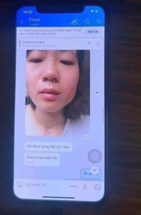 Hình ảnh cô giáo Lòng Xào Dưa, Hình ảnh cô giáo Hoa Hồng Tím, Cô giáo mầm non Lòng Xào Dưa, Cô giáo mầm non Hoa Hồng Tím Cô giáo Lòng Xào Dưa bị chồng đánh tím mắt, Cô giáo Hoa Hồng Tím Lòng Xào Dưa đã U50, Cô Giáo Lòng Xào Dưa sinh năm 1976, Cô giáo Lòng Xào Dưa là ai, Lòng Xào Dưa 30K là gì, Nội dung tin nhắn Lòng Xào Dưa 30K, Clip Lòng Xào Dưa 30K, Tin nhắn Lòng Xào Dưa 30K NÓNG như Truyện Sex, Em gái Lòng Xào Dưa 30K Dâm Dê, Em gái Lòng Xào Dưa 30K thích quan hệ tình dục, Em gái Lòng Xào Dưa nhu cầu quan hệ tình dục cao, Tìm Facebook em gái Lòng Xào Dưa 30K, Truyện Sex Lòng Xào Dưa 30K, Lòng xào dưa 30K trách chồng sức khỏe yếu, Facebook em gái Lòng Xào Dưa 30K, Tiểu tam thích ăn Lòng Xào Dưa 30k, Cô gái tiểu tam Lòng Xào Dưa 30K, Lòng Xào Dưa 30K, Lòng Xào Dưa 30K Thái Bình, Lòng Xào Dưa 30K chê vợ của tình nhân lười xôn xao Facebook, Cô giáo Lòng Xào Dưa U50 Hồi Xuân